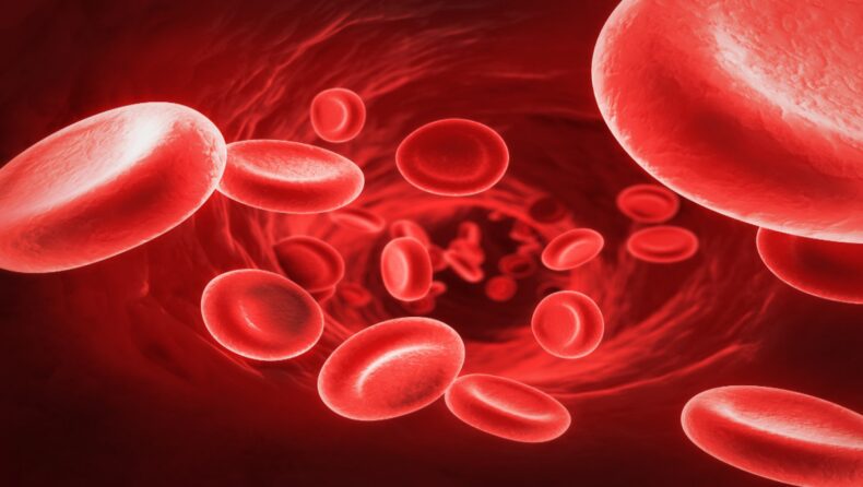 sickle cell disease- what is it?