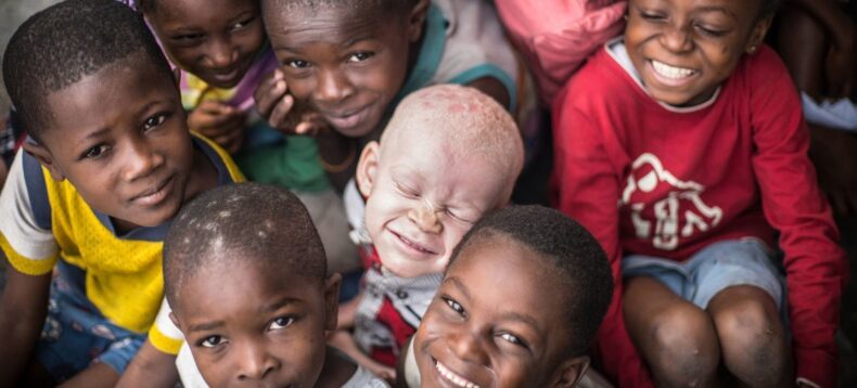 What does 13th June, The International Albinism Awareness Day signify