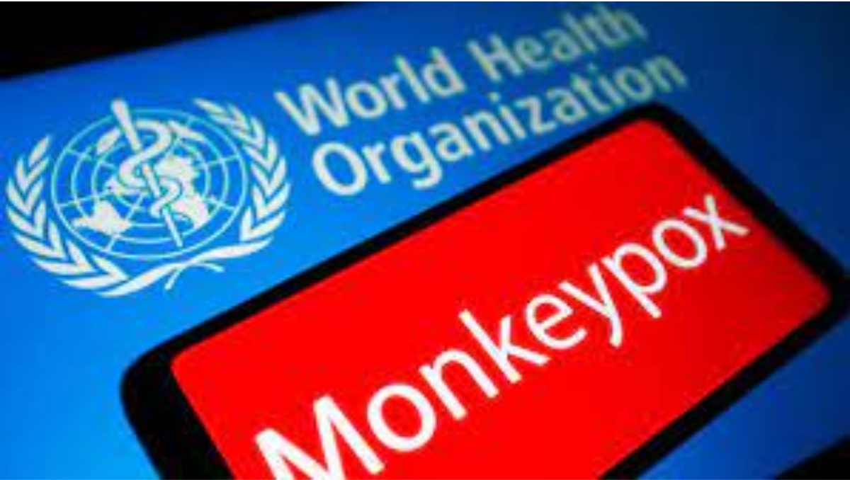 Monkeypox should be closely watched, is not a global emergency, says the WHO - Asiana Times