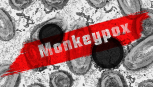 Delhi's First Monkeypox case: Man with no foreign travel history