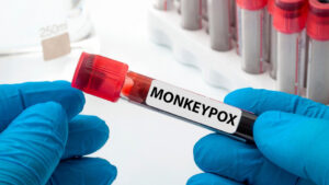 <strong>First Death due to Monkeypox In India</strong> - Asiana Times