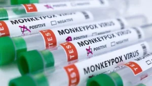 Third monkeypox case in Delhi
