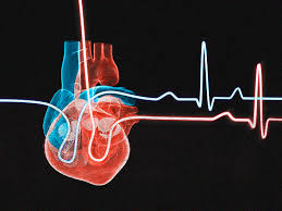 Cardiac issues despite good health routine and workouts - Asiana Times