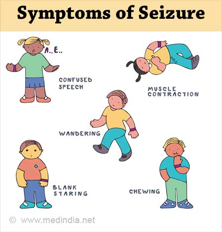 Symptoms of epilepsy