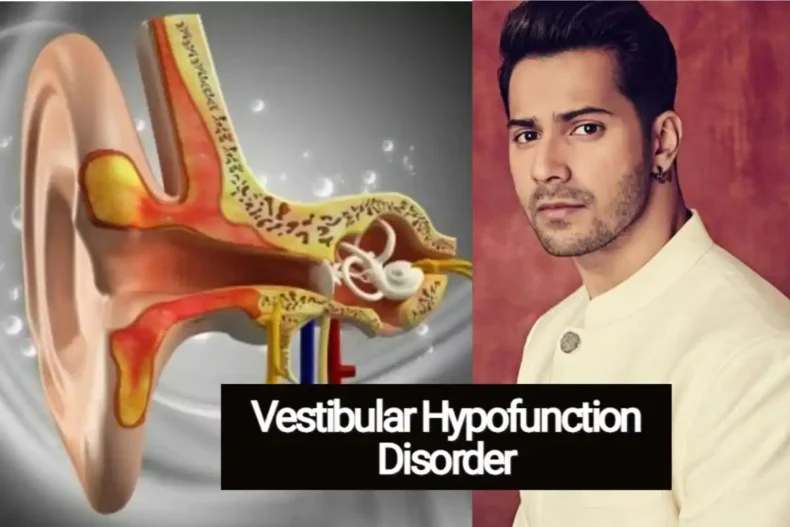Varun Dhawan Diagonesd with Vestibular Hypofunction Disorder