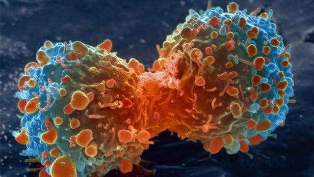 Tumors use to suppress Vulnerable responses