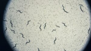 <strong>Tiny Worms to Screen Pancreatic Cancer Early</strong> - Asiana Times