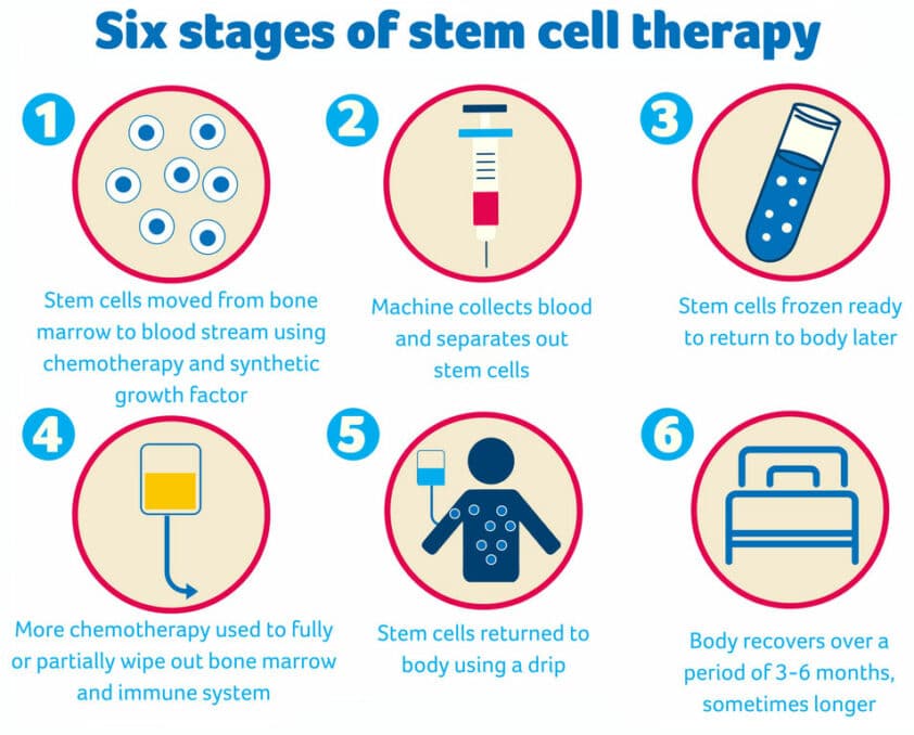 Stem cell therapy process