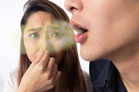 Halitosis? Use these 7 Ayurvedic remedies to prevent it - Asiana Times