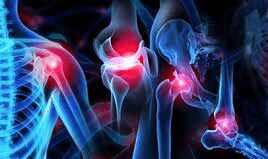 Orthopedic problems in winters: causes and solutions - Asiana Times
