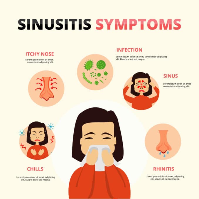 symptoms of sinusitis