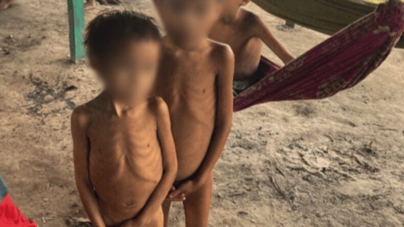Brazil's Yanomami children
