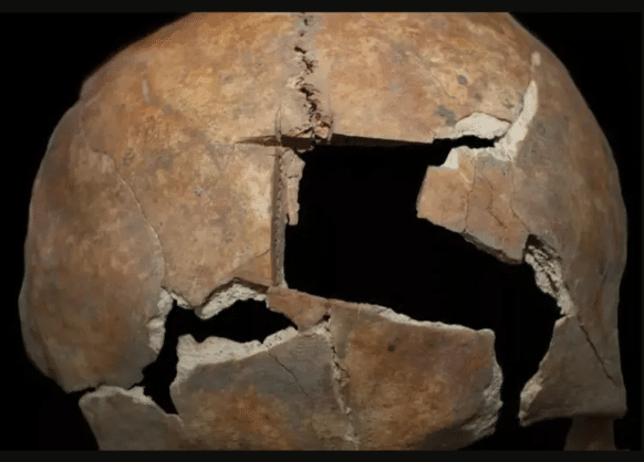 <strong> Evidence of Brain Surgery Found in 3000-Year-Old Skull</strong> - Asiana Times