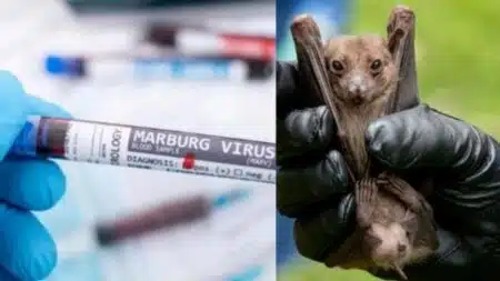 Marburg Virus - A Threat Confined to Equatorial Guinea or The Whole World - Asiana Times