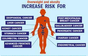 MORE THAN 10 "CANCERS" ARE RELATED TO obesity.Oncology(Cancer) - Asiana Times