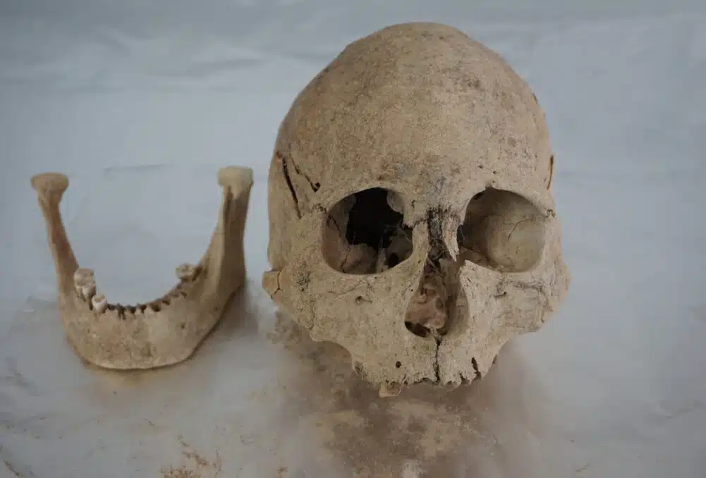 Cranium and mandible of an individual from Zongri (5213-3716 cal BP), an archaeological site in the Tibetan Plateau.