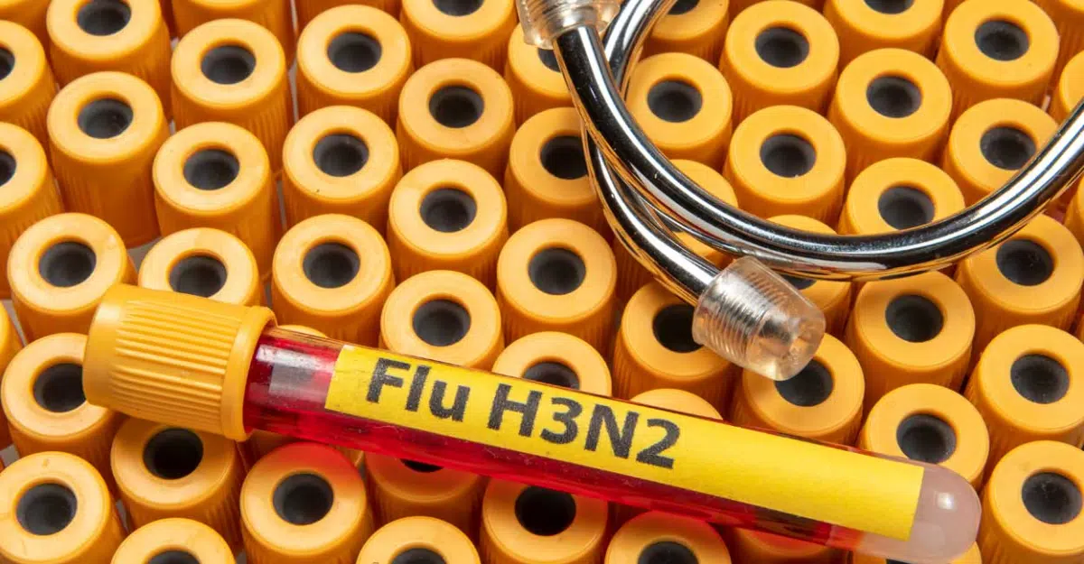 The H3N2 Influenza Virus is Contagious and Deadly - Asiana Times