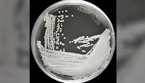 Increased Cases of Candida Auris: An Urgent Threat - Asiana Times
