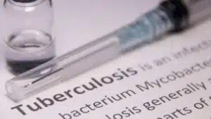 India has developed mathematical model to detect TB cases.