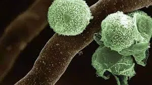 plant fungus as seen in microscopy
