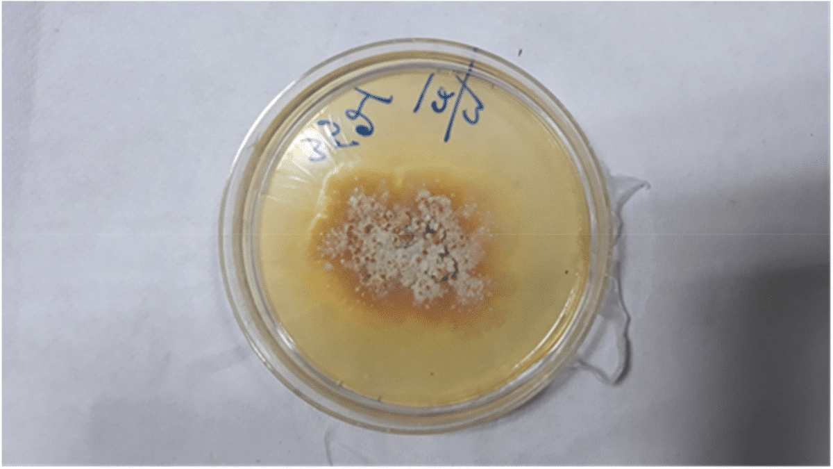growth of the plant fungus in the petri dish 