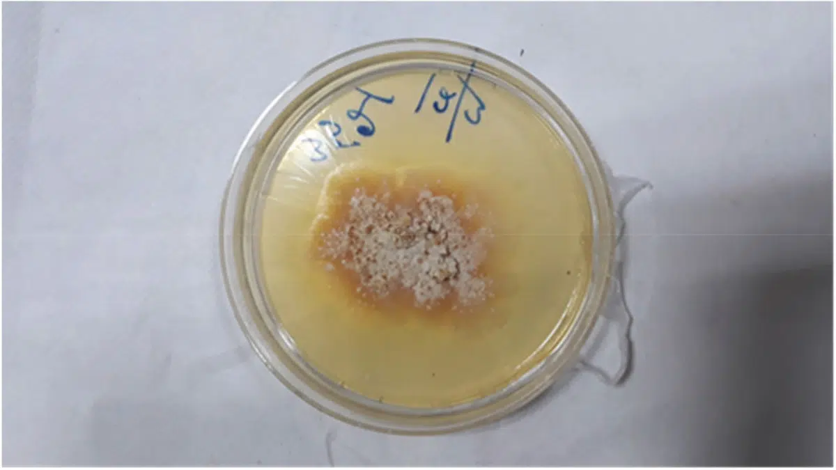 growth of the plant fungus in the petri dish 
