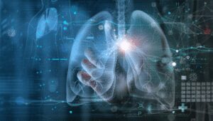 Can New AI detect Cancer Better? Can New AI detect Cancer Better? - Asiana Times