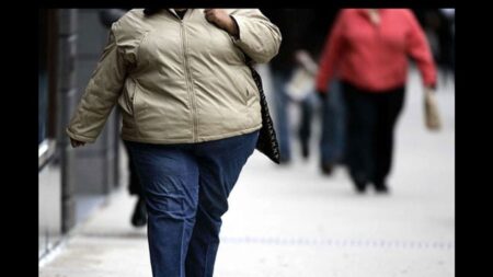 Obesity: A Mark of Prosperity in Developing Nations
