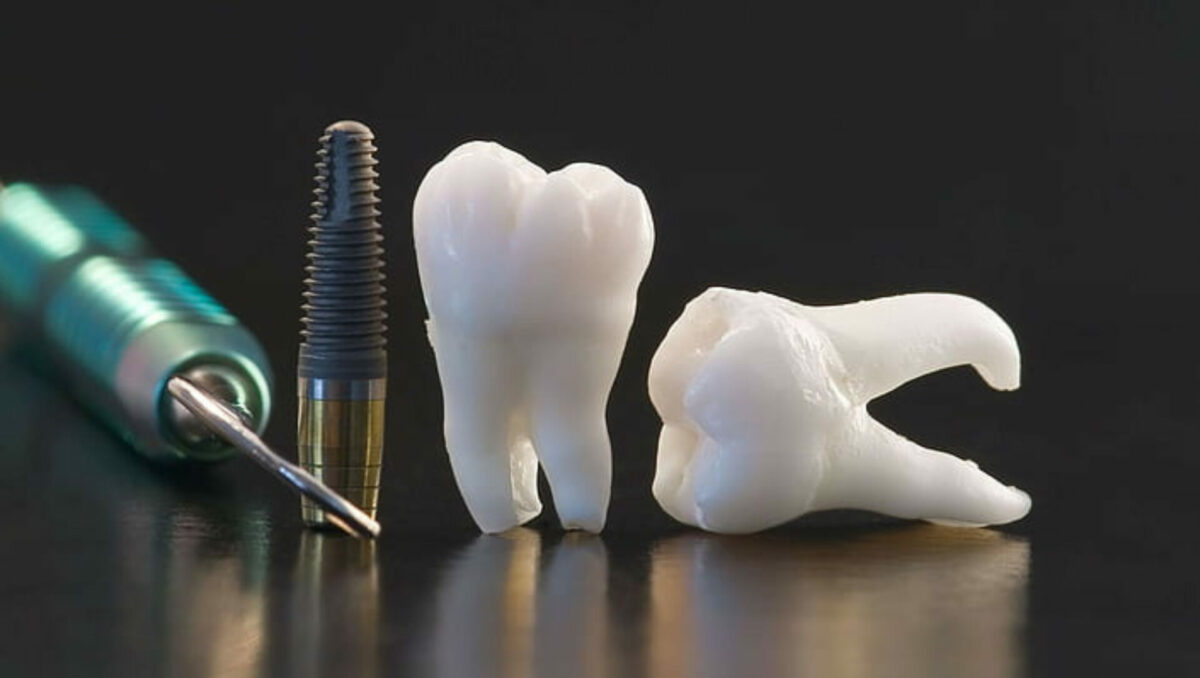 Regrowing of Teeth is not Sci-Fi anymore - Asiana Times