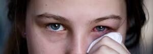 5 Causes Why sudden spike in Conjunctivitis? - Asiana Times