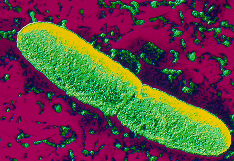 Yersinia pestis: Unraveling Insightful Pandemic Clues - Asiana Times