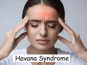 All about Havana Syndrome and why govt. in India is investigating it? - Asiana Times