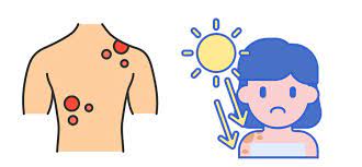 Tanning & skin cancer :4 Unconventional links - Asiana Times
