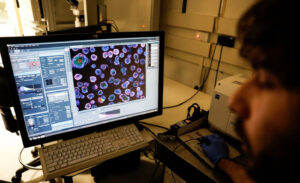Nir Livnat looks at a model of an early-stage human embryo