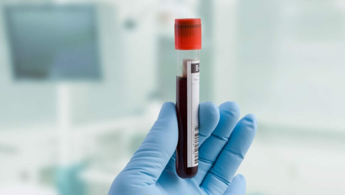 Researchers Achieve Major Progress in Liquid Biopsy - Asiana Times