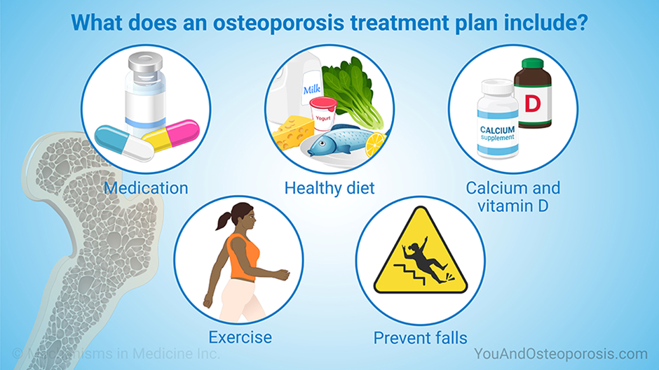 Ways to prevent Osteoporosis
