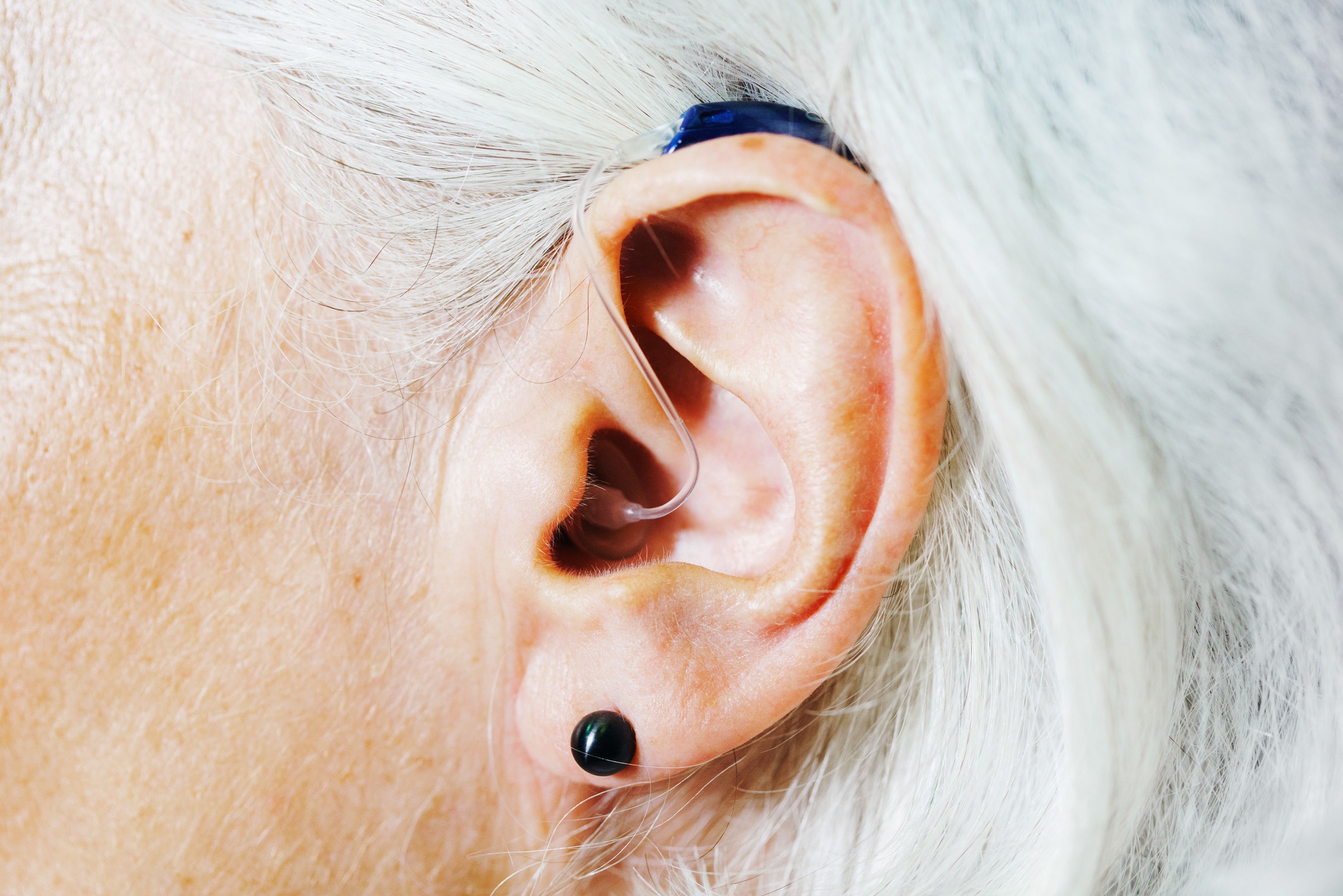 Hearing Aids Halve Dementia Risk: Study - Asiana Times