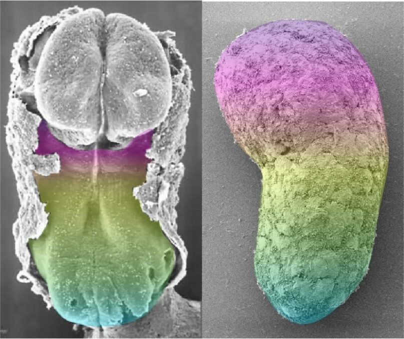 Peri-Gastruloids: A Key Insight into Early Development - Asiana Times