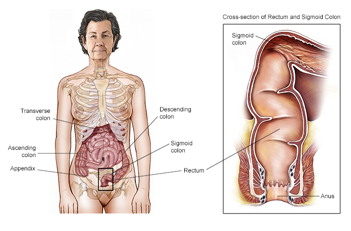 Unmasking Disparities: High-Risk Communities Fight Back Against Colorectal Cancer

