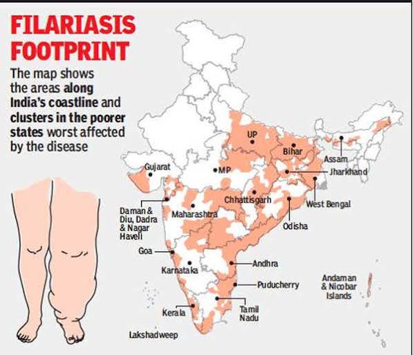 Combating Elephantiasis: India's Efforts To Overcome A Serious Disease